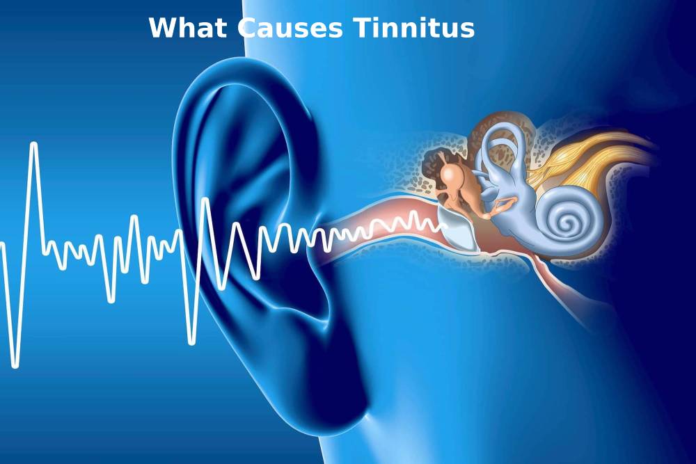 What Causes Tinnitus